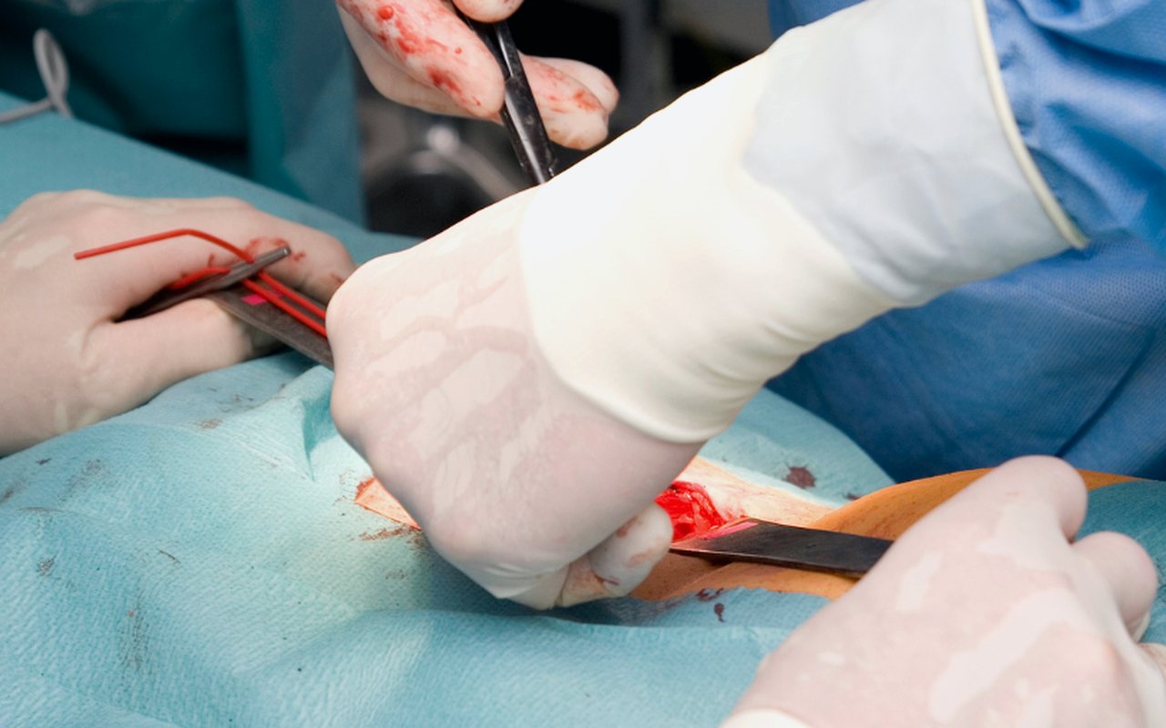 Tratamiento de heridas complejas en Tijuana con el Dr. Ari Salvador Salgado Rodríguez