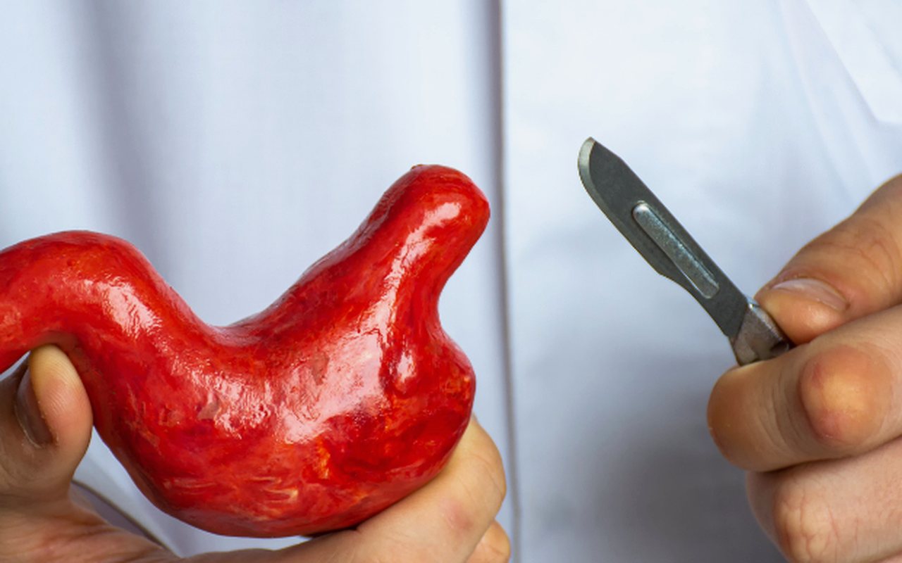 Cirugía de hernia hiatal en Tijuana con el Dr. Ari Salvador Salgado Rodríguez